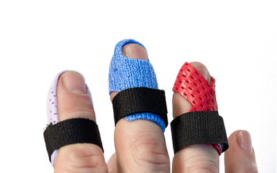DITO A MARTELLO NELLA MANO: Mallet finger o lesione di Segond?