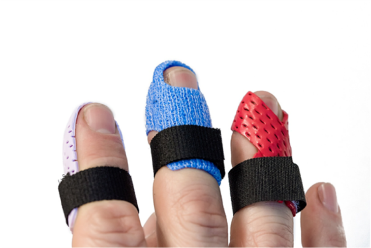 DITO A MARTELLO NELLA MANO: Mallet finger o lesione di Segond?