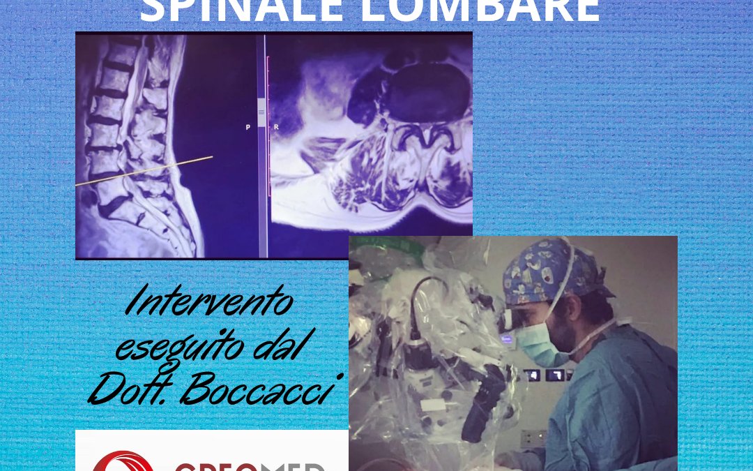 STENOSI DEL CANALE SPINALE LOMBARE