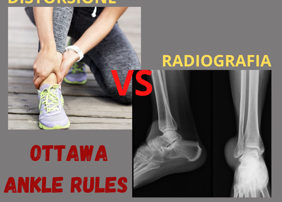 RADIOGRAFIA (RX) NELLA DISTORSIONE DI CAVIGLIA.